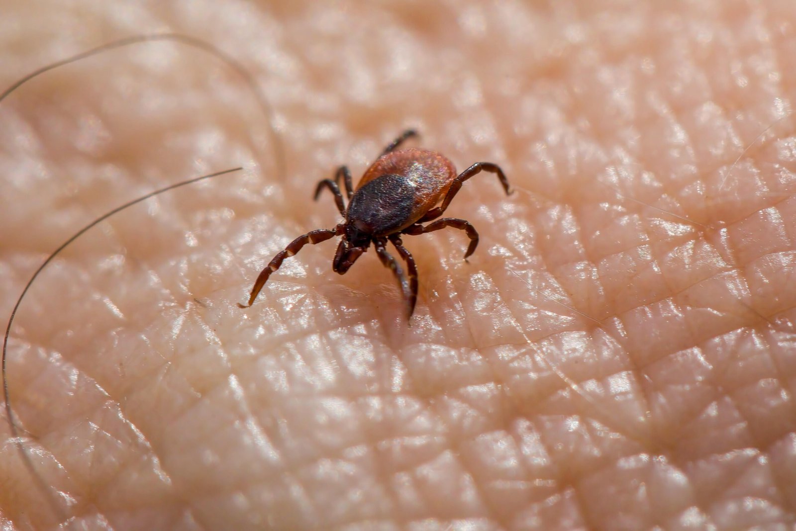 Recognizing Symptoms of Lyme Disease